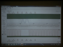 Nuken tuottamaa dataa. Ylin käyrä kuvaa ventilointia ja alin käyrä painelun tahtia ja syvyyttä. Hyvä apuväline joka paljastaa suoraan elvytyksen tehokkuuden.